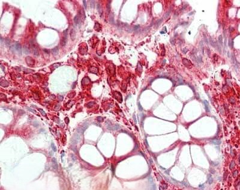 TUBA1B Antibody