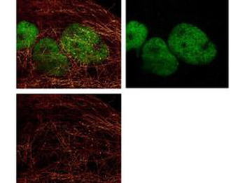 TUBA1B Antibody