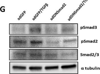 TUBA1B Antibody