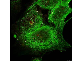 TUBA1B Antibody