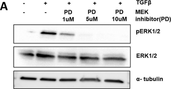 TUBA1B Antibody