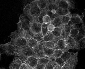 TUBA1B Antibody
