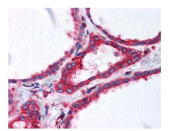 TUBA1B Antibody
