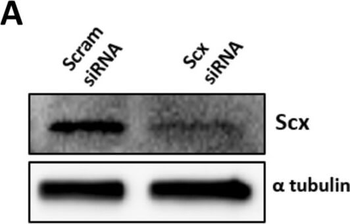 TUBA1B Antibody
