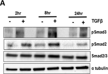 TUBA1B Antibody