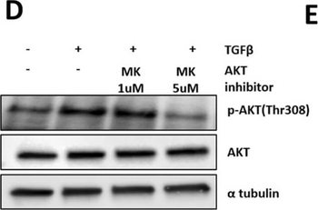 TUBA1B Antibody