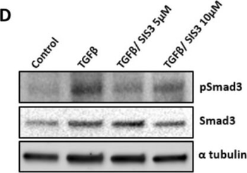 TUBA1B Antibody