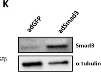 TUBA1B Antibody
