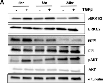 TUBA1B Antibody