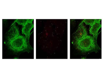 TUBA1B Antibody