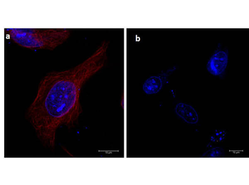 TUBA1B Antibody