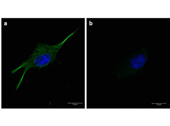 TUBA1B Antibody