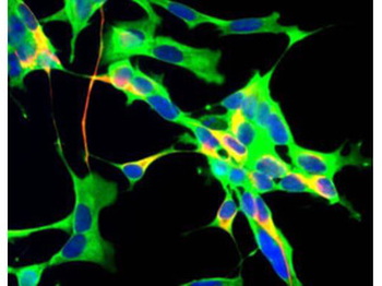 GAPDH Antibody