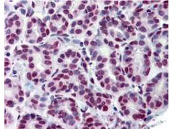 Stat5a Antibody