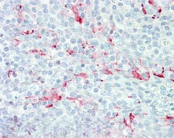 MSLN Antibody