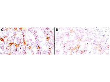 MSLN Antibody