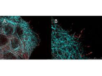 AKT1 Antibody