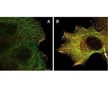 AKT1 Antibody