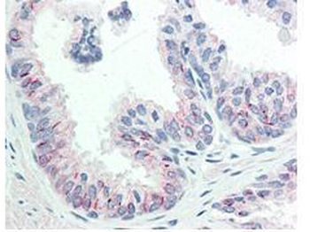 AKT1 Antibody
