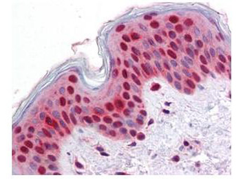 Stat2 Antibody