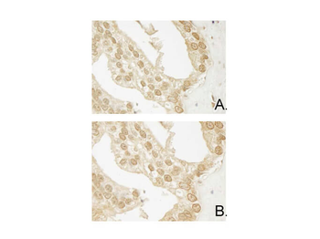 AKT3 Antibody (FITC)