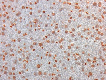 AKT3 Antibody (FITC)