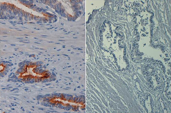 AKT1 Antibody (Biotin)