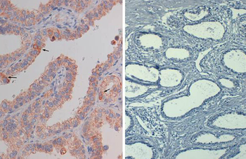 AKT1 Antibody (Biotin)