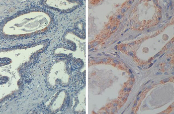 AKT1 Antibody (Biotin)