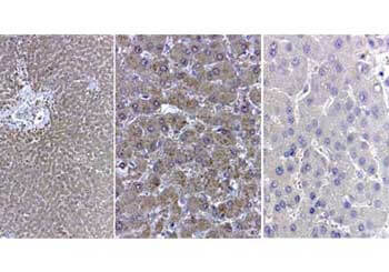 CAT Antibody