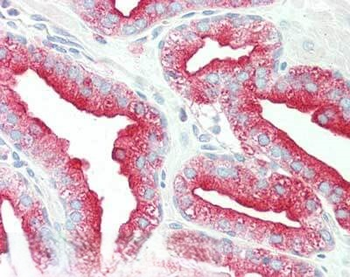 TMBIM1 Antibody