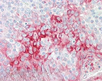 TMBIM1 Antibody