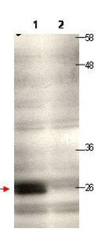 CENPQ Antibody