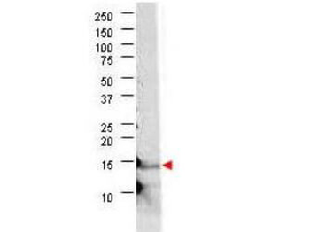 IL21 Antibody