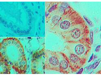 IL17F Antibody (Biotin)