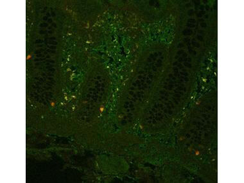 TNF Antibody