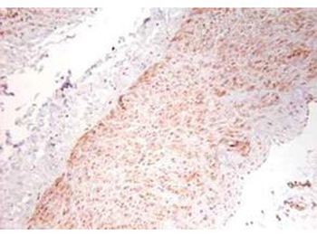 TNF Antibody