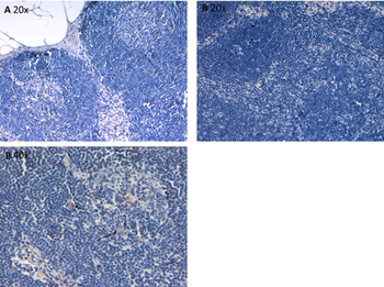 IL6 Antibody