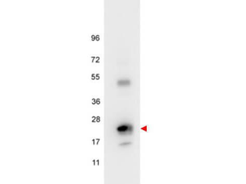 IL6 Antibody