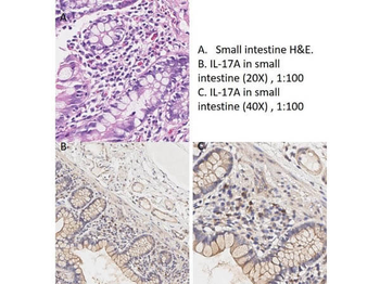 IL17A Antibody