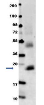 Il6 Antibody