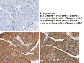 Il6 Antibody