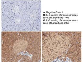 Il6 Antibody