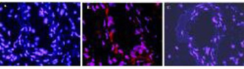 Il1b Antibody