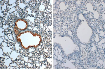 Il1b Antibody