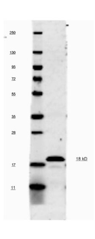 Il1b Antibody