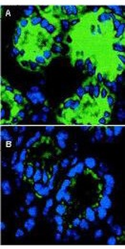 Il18 Antibody