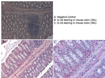 Il18 Antibody