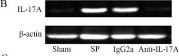 Il17a Antibody
