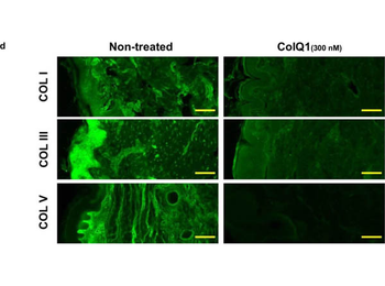COL1A1/A2 Antibody